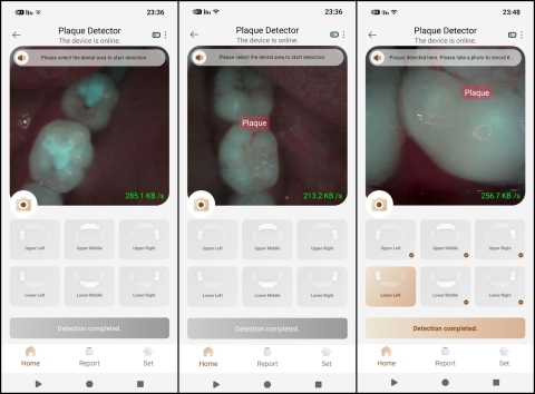 Mova Fresh 20 Vision: משנה הרגלים