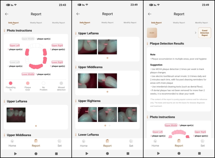 Mova Fresh 20 Vision: משנה הרגלים