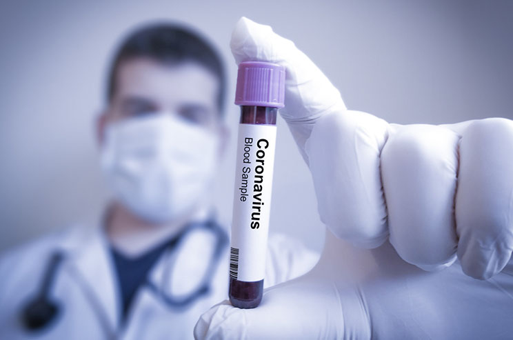 iOS 13.5 תעזור לנו עם הבעיה הזו