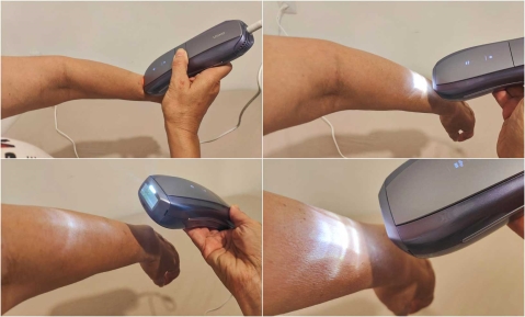 Ulike Air 10: פשוט לשימוש וללא כאב